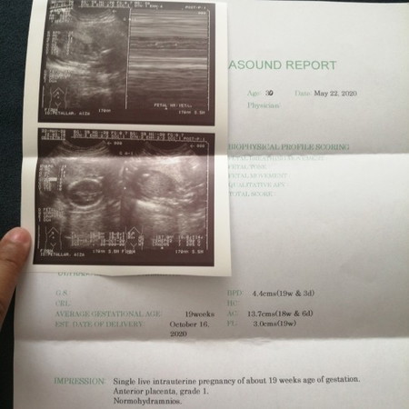 Ultrasound