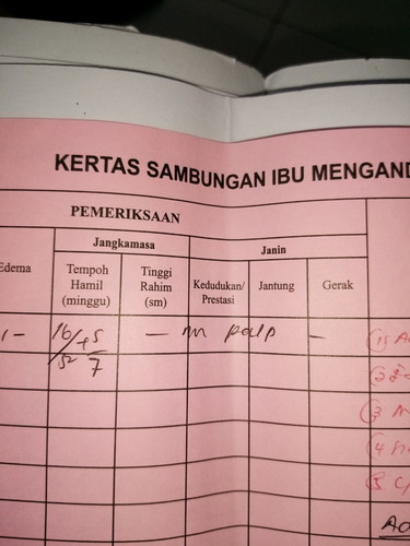 Ibu Risau..