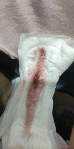 3days na po ako nagbbleed, pero nainom naman ako ng duphaston, galing na ko check up last feb. 6