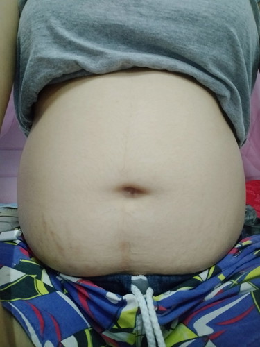 ถามแม่ๆค่ะ