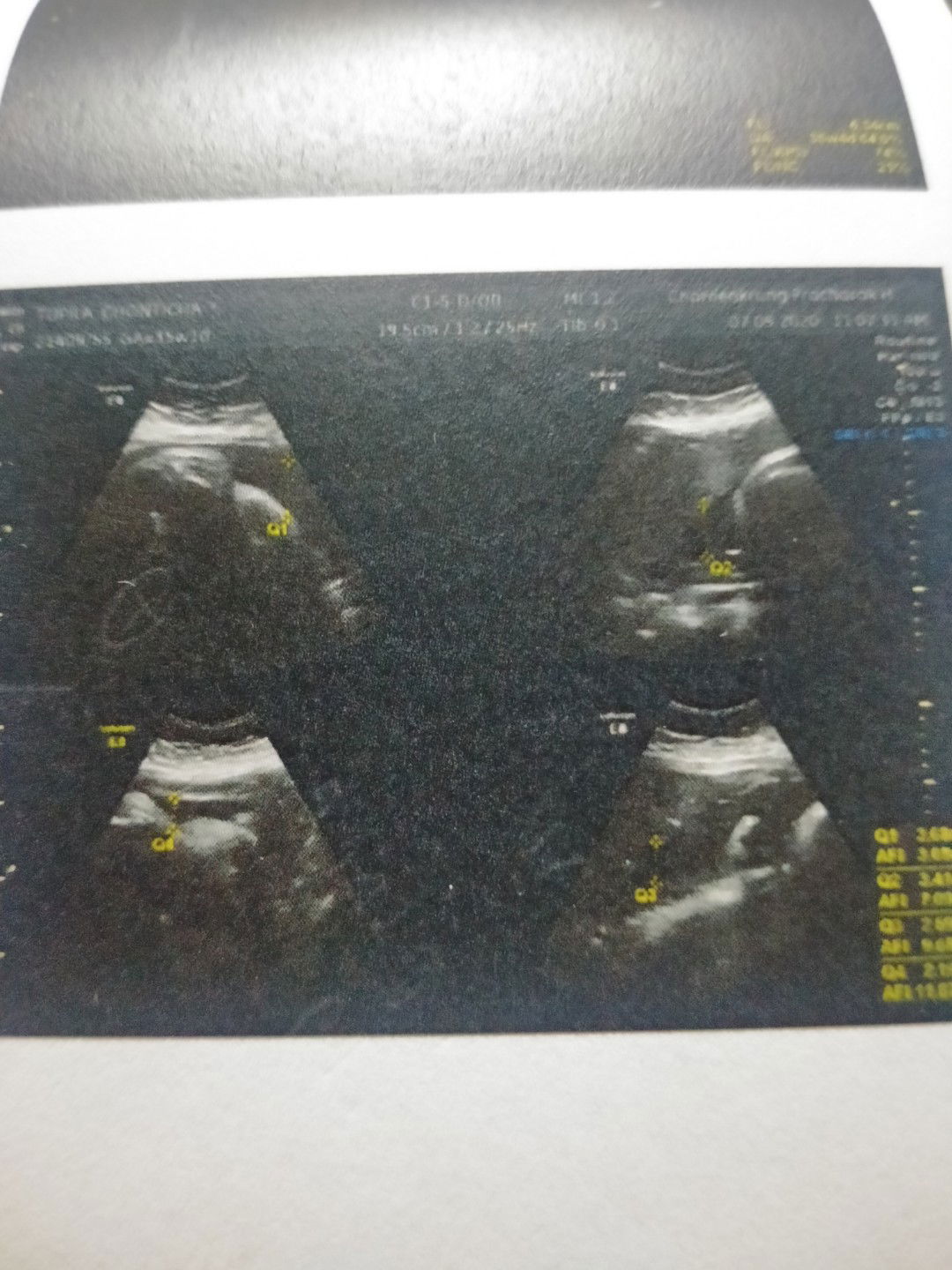 อยากปรึกษาทุกคนค้ะ