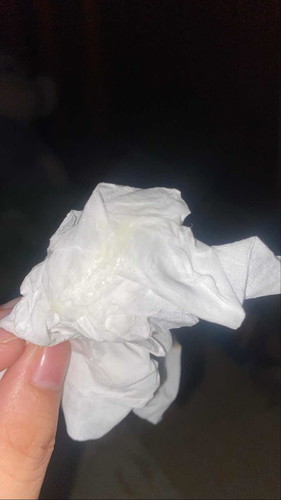 ตกขาวหรือมูกใส