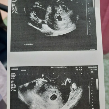 พอมีหวังจะเจอน้องอยู่มั้ยคะ