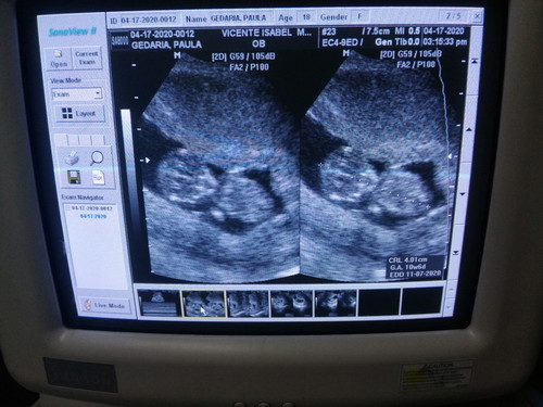 10weeks 6days