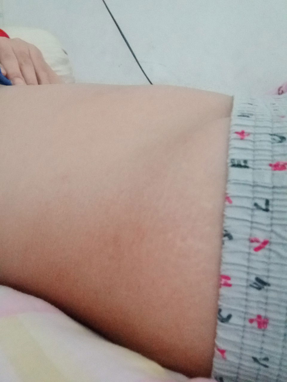 14W5D  ท้องเล็กไปมั้ยคะ