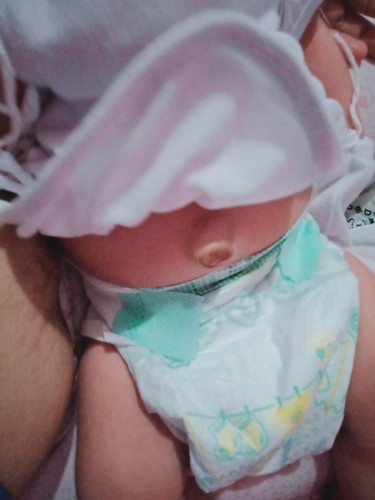 Umusle ang pusod