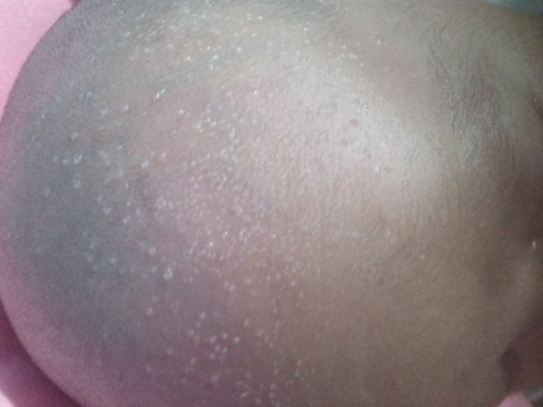 bintik kecil kaya berair