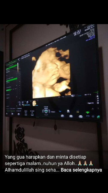 Ade Aprianti profile icon