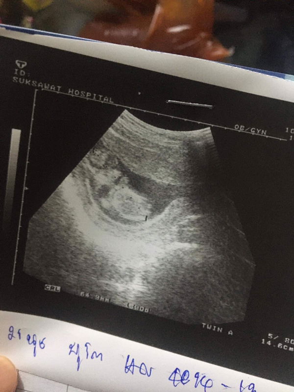 ผิดที่ผมไม่ดี หรือผมไม่มี profile icon