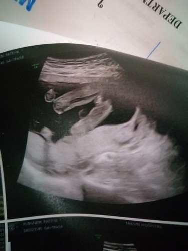 แบบนี้ผู้หญิงหรือชายผู้ชายคะ