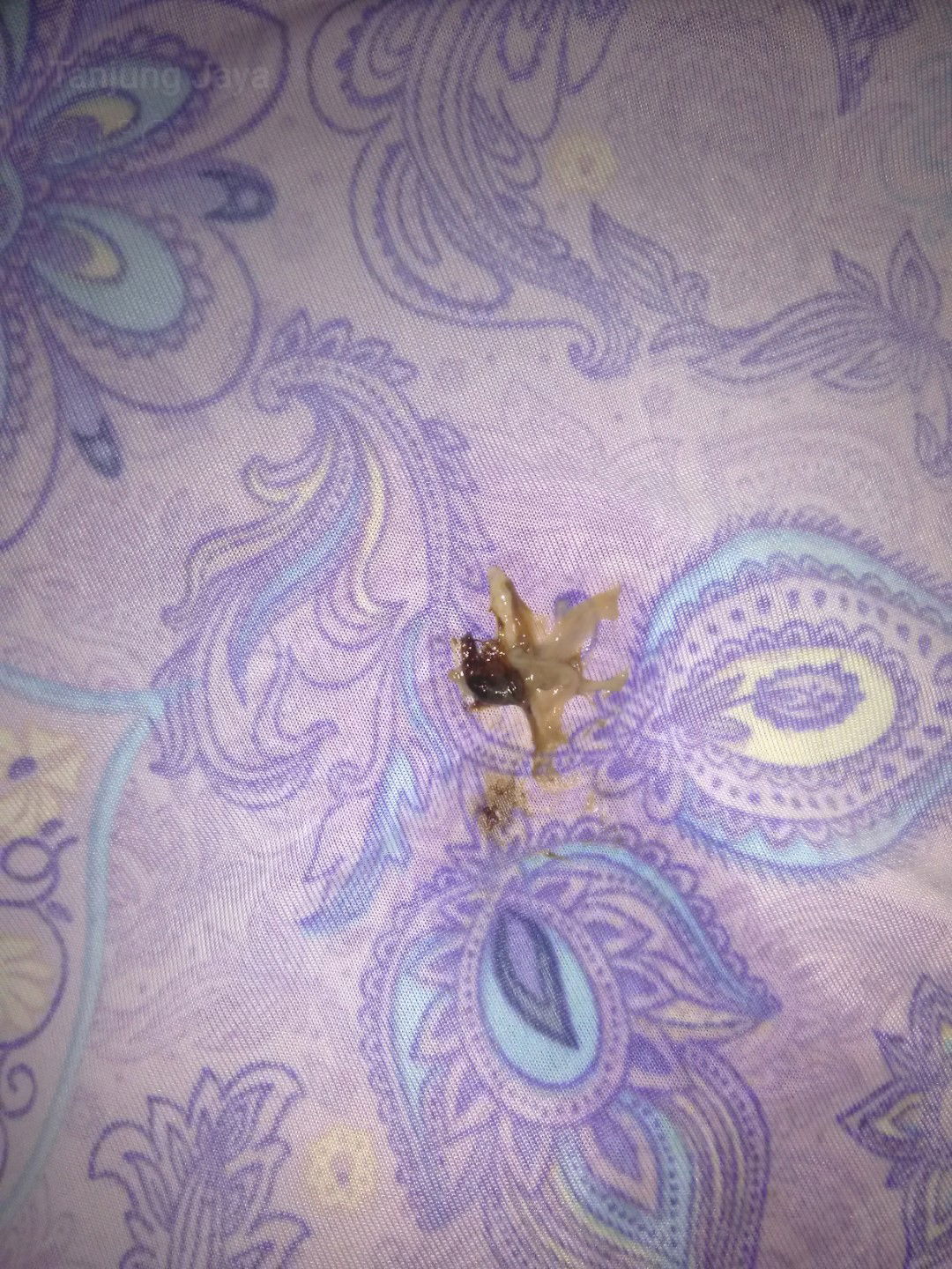 keluar lendir coklat kehitam-hitaman