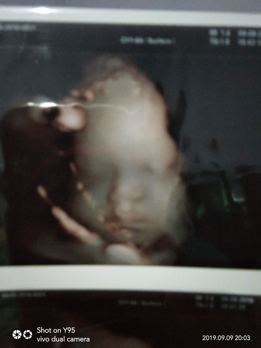 bismillah.. semoga segera lahiran..