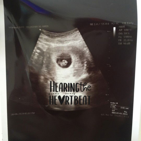 Syukur to Allah 🌸