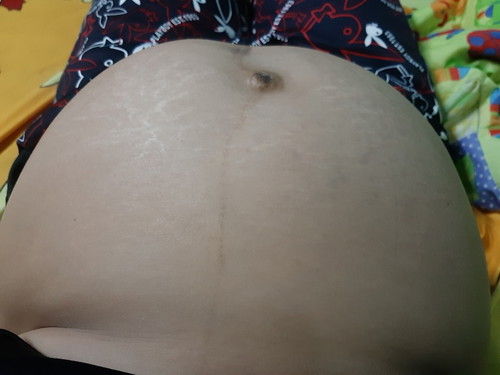 7เดือนและยังไม่รู้เพศเลยค่ะ