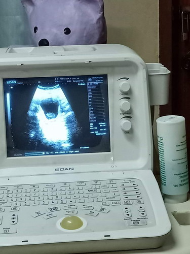 9weekแล้ว