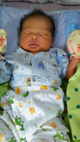 badan bayi kuning dan sulit dibangunkan dari tidur
