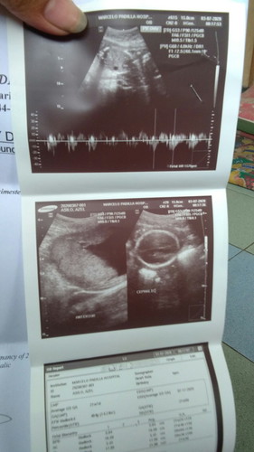 what is the possibility gender of my baby?