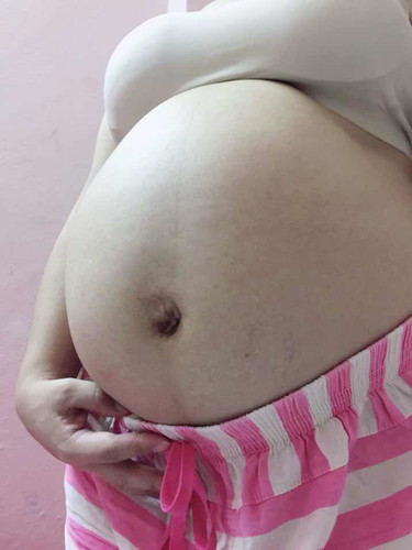 34+2week