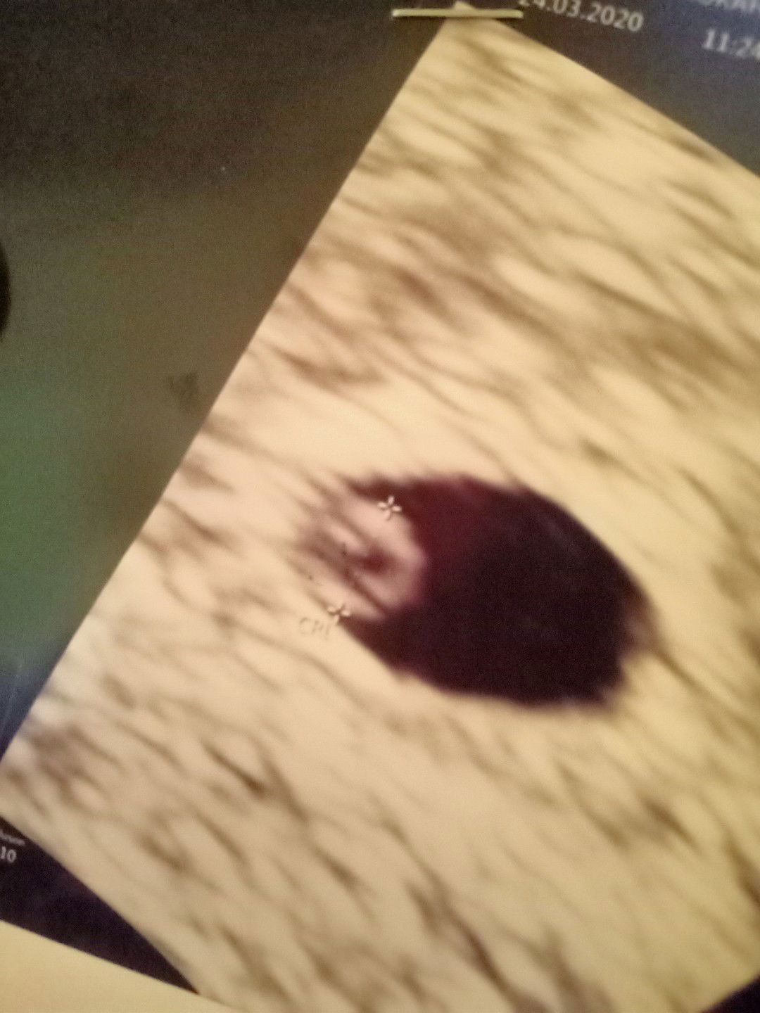 detak jantung belum terdeteksi?