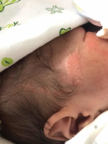 มีลูกบ้านไหน มีรอยแบบนี้บ้างไหมคะ ?