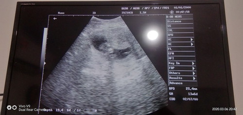 wanita hamil boleh makan mie instan