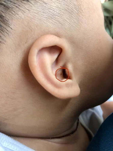 ขอสอบถามแม่ๆค่ะ