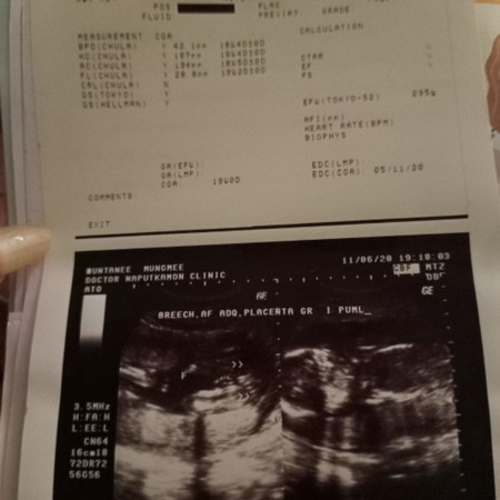 21+4 เดือนตุลาคคะ