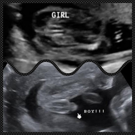 เรื่องเพศลูก—- เจอมาเลยเอามาฝากค่ะ ?