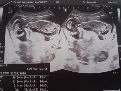 15 w??