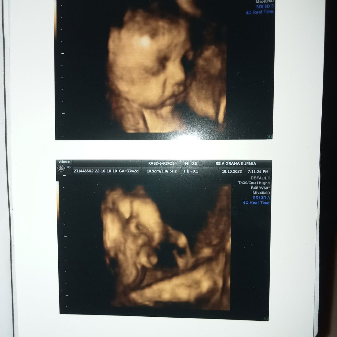 Feny Suroso profile icon