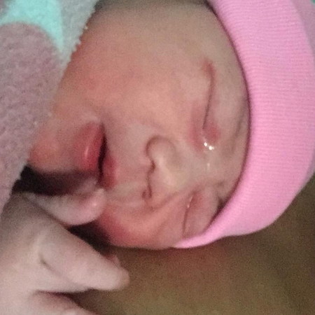 คลอดลูก40+1