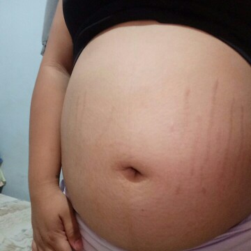 pregnant