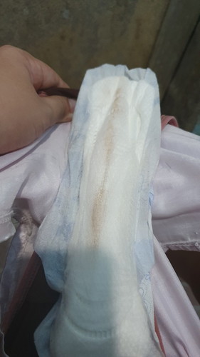 Brown discharge???