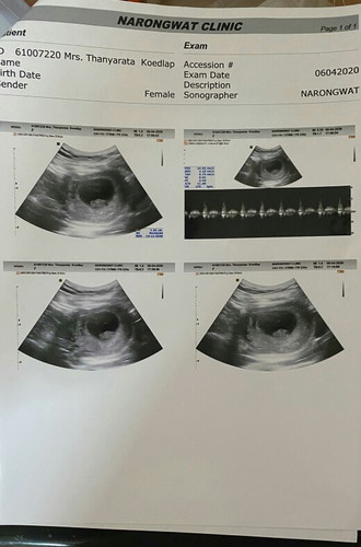 8w3d