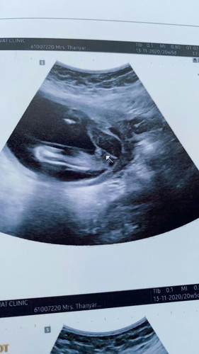 ช หรือ ญ บอกที