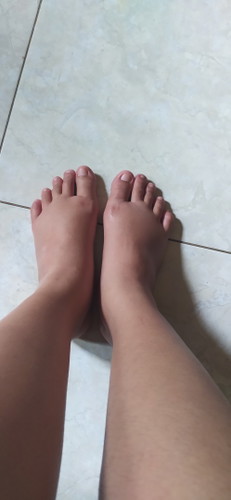 Kaki Membengkak