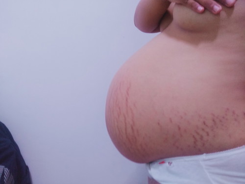 38wks and 2 days, baby girl FTM EDD: June 25