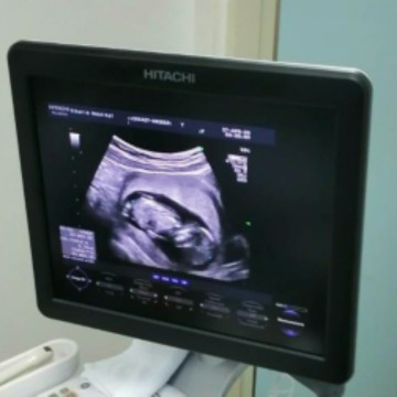 ขนาดของลูกเท่าไรกันบ้างคะ 12w5d