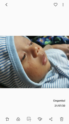 bayiku beruntusan gitu bun.. obatnya apa yahh