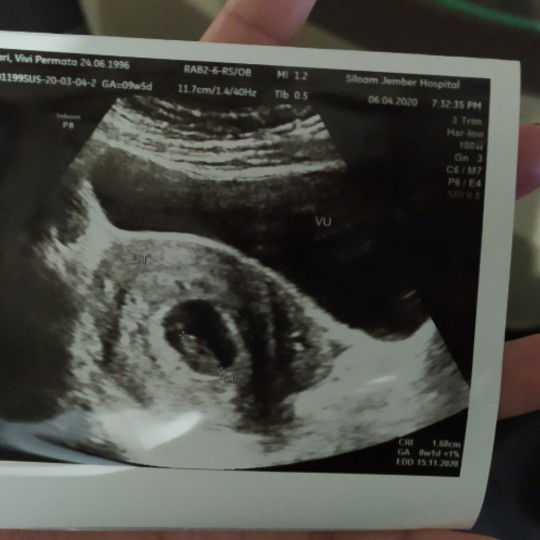 denyut jantung tidak terdeteksi