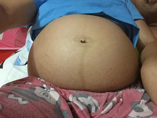 Boy or Girl?
