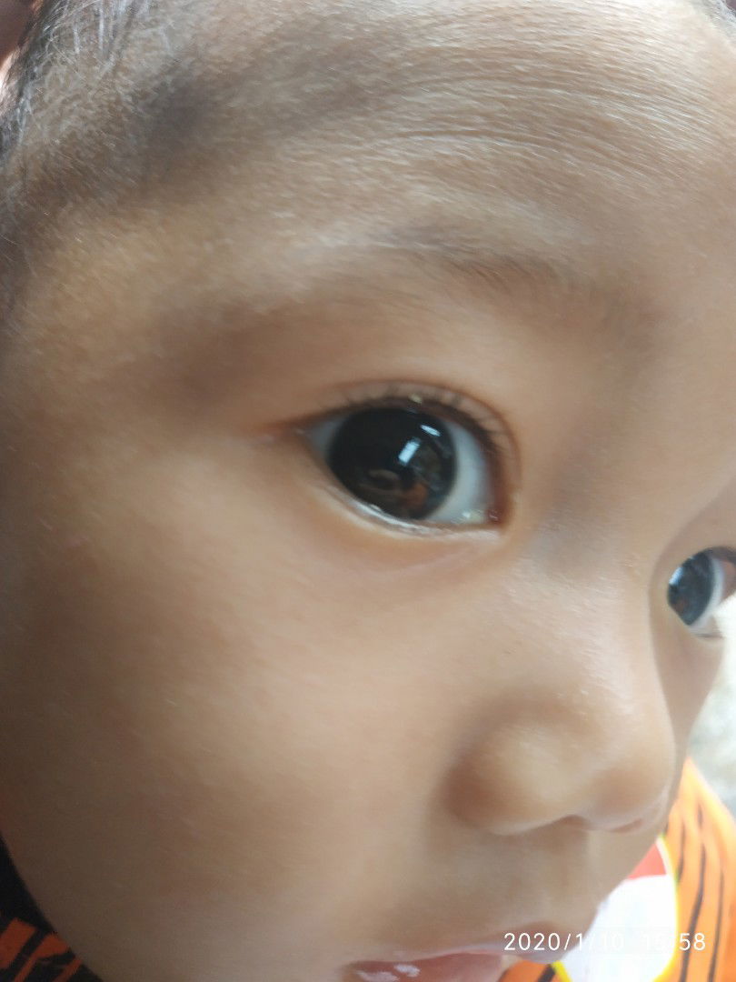 Bayi 7 bulan Belekan