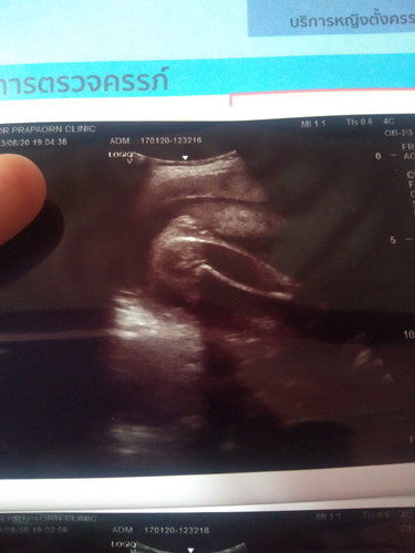 แม่ๆว่าผู้หญิงรึผู้ชายค่ะ