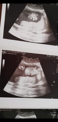 Ada Sedih Ada Gembira