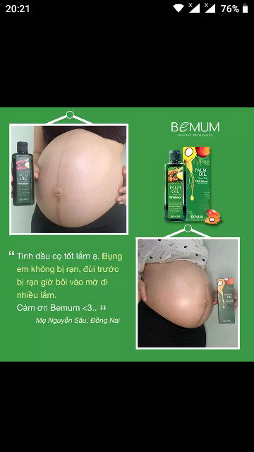 Tinh dầu trị rạn da