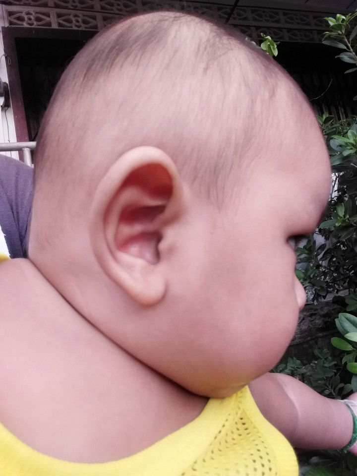 คอผมหายไปไหนหมดเเล้วคับเนี้ย 555 ??