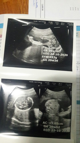 อัตราซาว ?