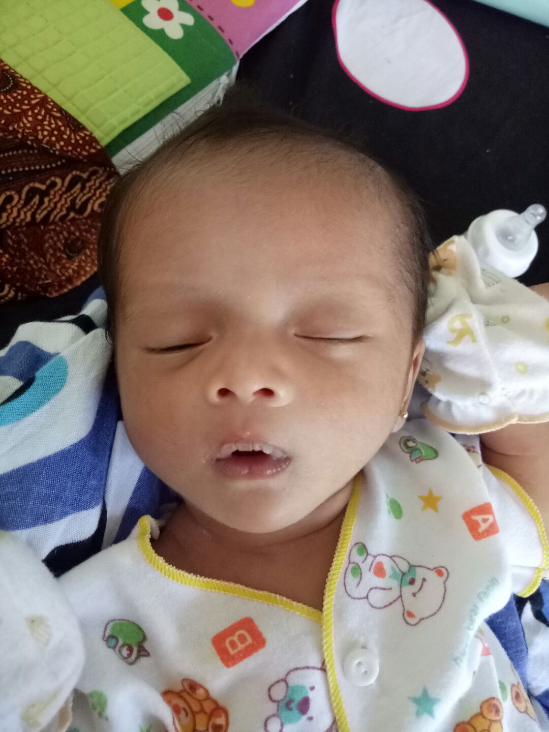 bibir bayi kering