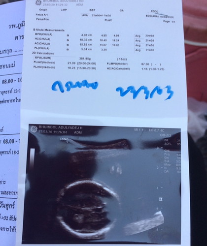21 Week ? แม่บ้านไหนกำหนดคลอดสิงหาบ้างคะ ขอดูท้องหน่อยจ้าท้องเล็กไปมั้ยคะ ท้อง2คะ