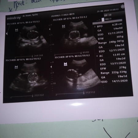 baby twin